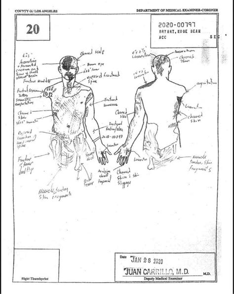 kobe brayant autopsy|File : Kobe Bryants autopsy report, 2020.pdf